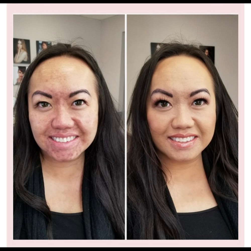 Set of 2. Hide scars, rosacea, melasma! Best wet/dry concealer!
